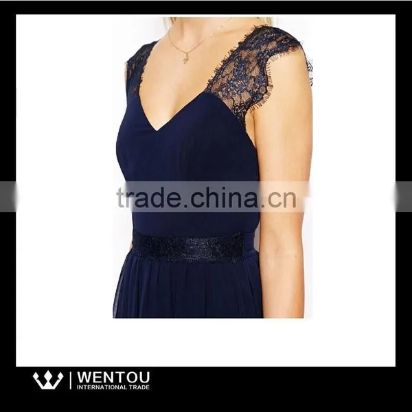 European Style Women Sleeveless Casual Lace Dress photo-2