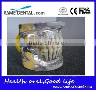 Transparant Deciduous Teeth Model Teaching And Hospital Demonstration photo-2