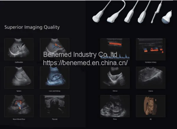 Portable 4D Color Doppler Ultrasound Scanner BENE-3V photo-4