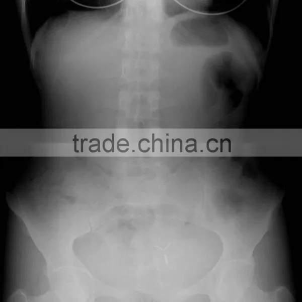 Medical X-ray DR Panel Detector photo-6