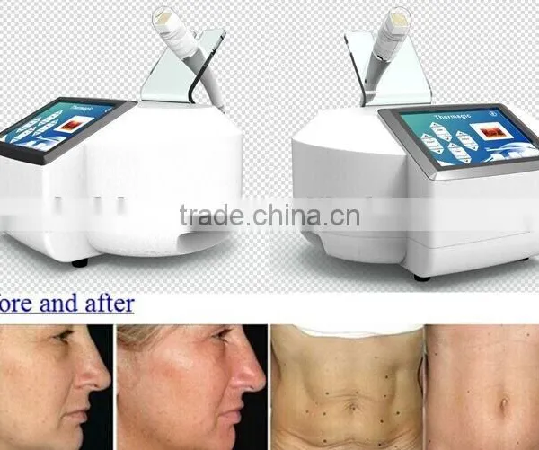 Hot Sale Portable Home-use RF 9D Thermacool Skin Resurfacing and RF Thermacool Effectively Machine photo-5