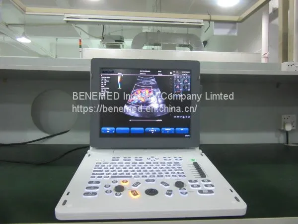 Echo Color Doppler Ultrasound Scanner Bene-5