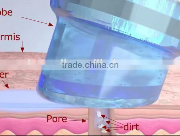 Beauty Equipment Microdermabrasion Machine Peeling Diamond Tips for Acne Removal Acne Suction photo-4