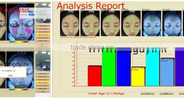 Auto Facial Skin Portable Analyzer With Customer Datebase and 10 Mega Pixels Camera photo-4
