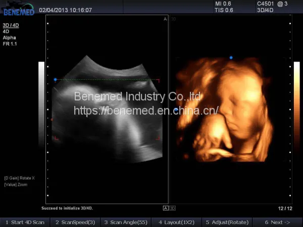 Portable 4D Color Doppler Ultrasound Scanner BENE-3V photo-3