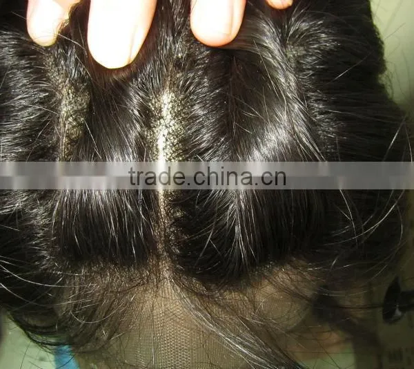 3 Parts Lace Frontal