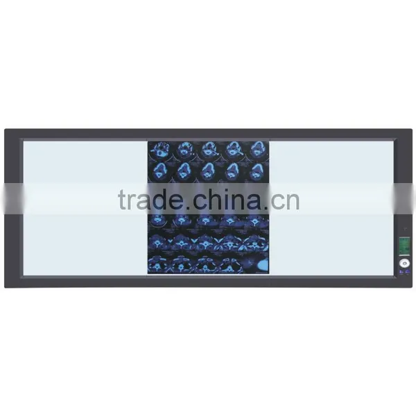 Medical Laboratory Equipment x Ray Film Viewer