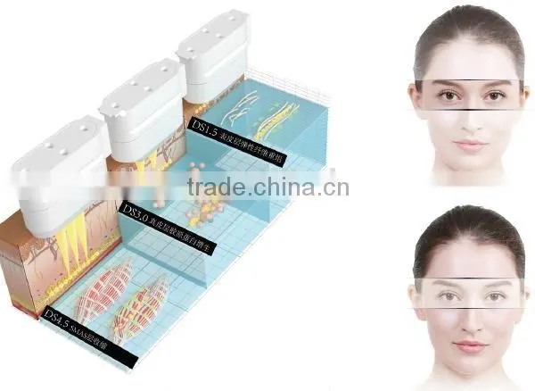 GLM Real High Intensity Focused Ultrasound Hifu Lifting,Different Depths of 1.5mm,3.0mm,4.5mm photo-5
