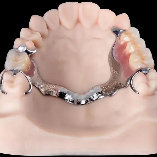 Myy International Dental Lab All on 4/6 Dental Manufacturer photo-3