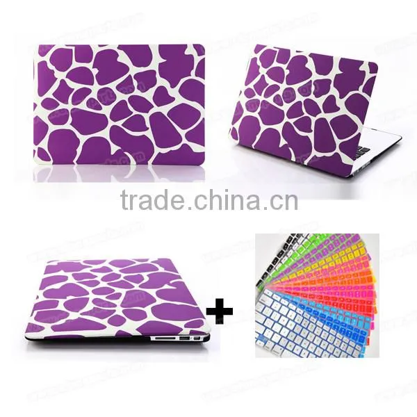 for Apple Macbook Pro 11 Case, Matt Cover Case for Macbook Pro Retina 11 13 15, for Macbook Air 11 13 Case photo-4