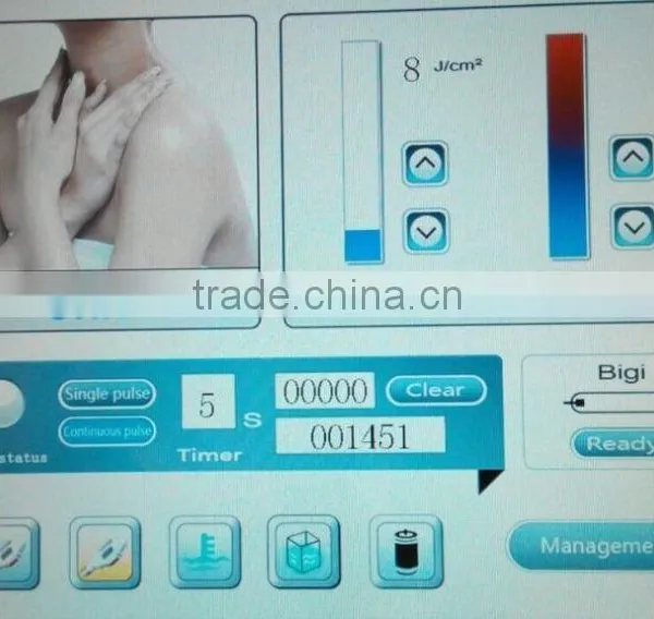 Men Hairline Shr Elight Diode Leg Hair Removal Laser Hair Removal Device photo-6