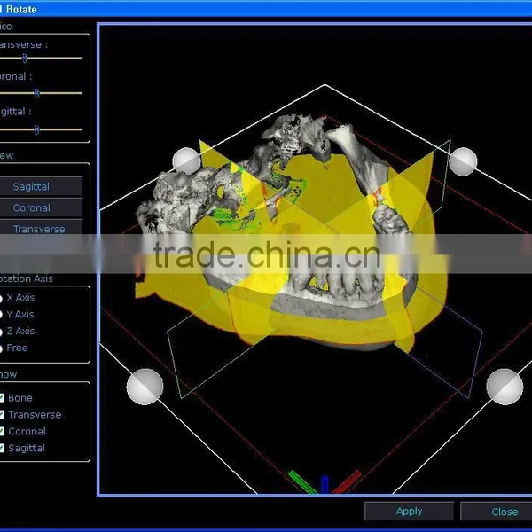 10DR Implant V2 Software-CT