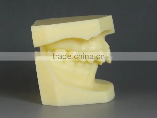 Malocclusion Classification Demonstration Model 2 photo-4