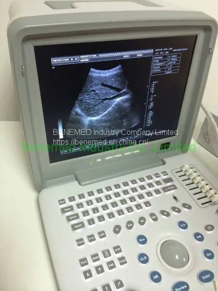 Portable B/W Ultrasound Scanner With Clear Image Quality Hospital Equipment photo-3