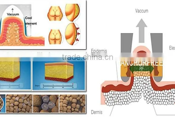 Body Fat Analysis Vacuum Treatment Head Slimming Machine photo-3
