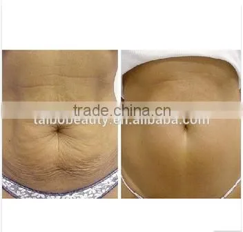 Cryolipolisis Fat Freeze Machine Body Sculptor Slimming Freezer Body Contouring Beauty Salon Equipment Supplier photo-6