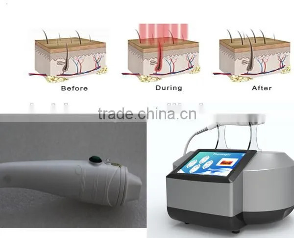 Hot Sale Portable Home-use RF Thermacool Wrinkles Eliminate and Facial Shape BR818 With CE photo-4