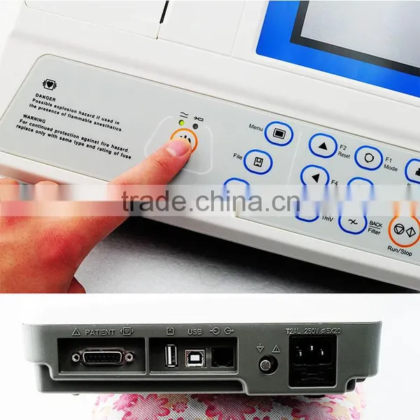 Multiple Printing Modes 5 Inch Color LCD Portable Ekg Machine / Electrocardiograph photo-5