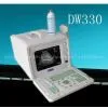 Full-digital Portable Ultrasound Scanner China photo-1