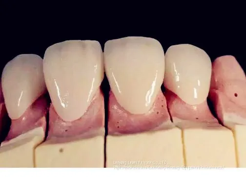 Factory Direct Dental Lab Supply Quality Zirconia Sintering Dental Lab Equipment photo-5