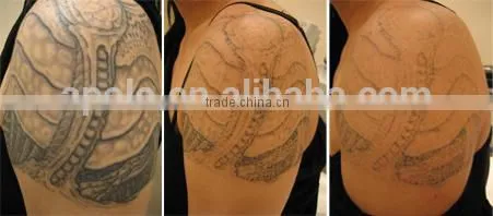 Chinese Apolo ISO CE Approved Beauty Machine Top Tattoo Machine photo-4