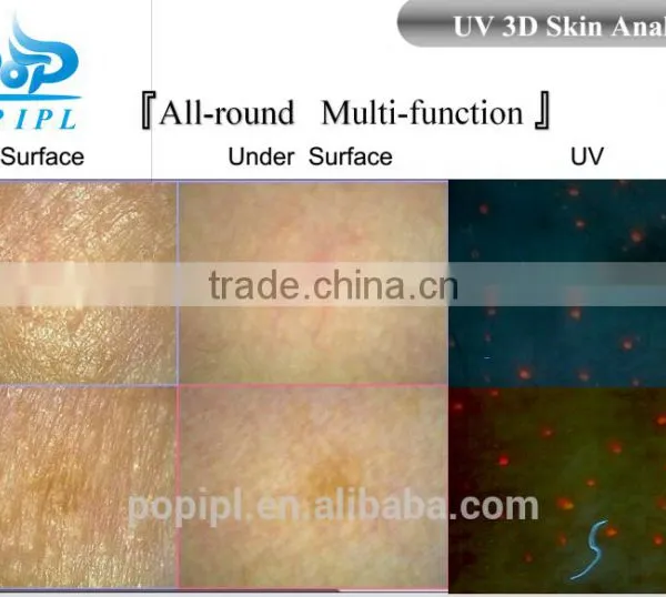 Factory Price UV 3D Facial Skin Analyzer photo-4