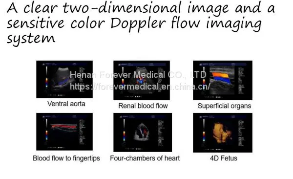 China Trolley 4D Color Doppler Ultrasound (YJ-U10T) photo-5