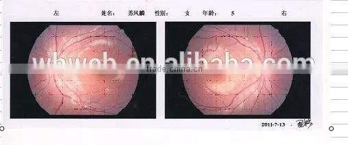 China MCT-A/High-end MCT Technology For Child Amblyopia photo-2