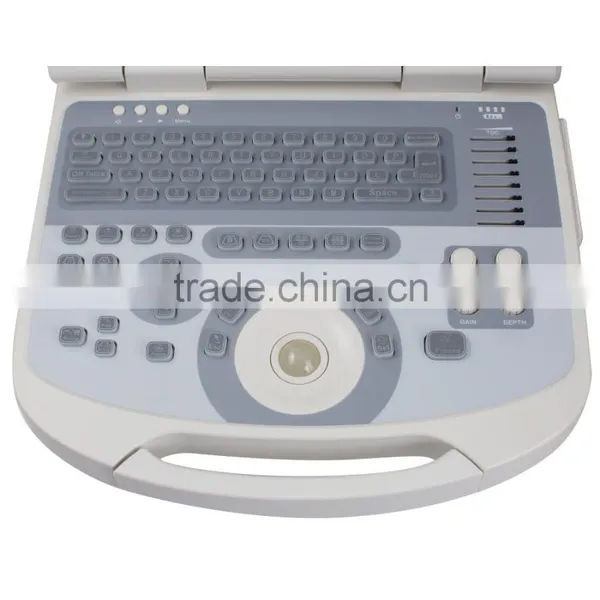 Full Digital Portable Ultrasound Scanner With 96 Elements Probes photo-6