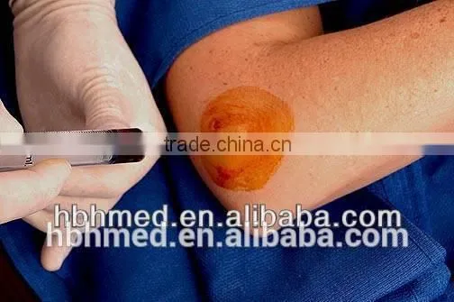 High Quality Injection Prp Kit photo-4