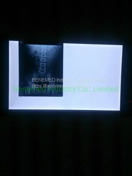 Ultra Slim LED Hospital X-ray Film Viewer Double Section photo-2