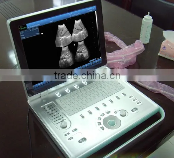 Sonostar Hospital Veterinary Equipment B Model Ultrasound Machine for Sale V9 photo-3