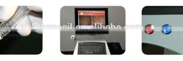 Professional Jetpeel Skin Rejuvenation Machine photo-2
