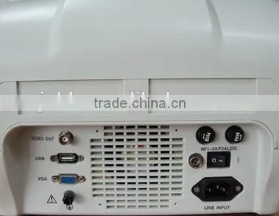 CE Approved Portable B-Mode Ultrasound Scanner With 3.5Mhz Multi-frequency Convex Probe RUS-6000A photo-4