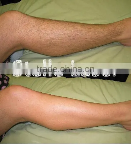 Professional Micro Channel Laser Depilation Aesthetic Machine Portable 808nm Diode Laser Hair Removal Machine photo-4