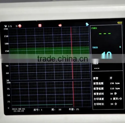 Good Price Fetal Monitor Fetal Heart Rate Monitoring Electronic Fetal Monitoring photo-5