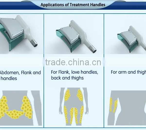 CE / FDA Approved 2 Cryo Handles Cellulite Lipo Slim Cellulite Reduction Fat Freezing Liposuction Machine photo-3