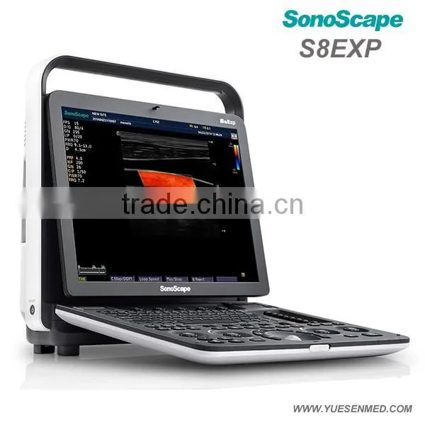 Sonoscape S8Exp Portable Color Doppler Ultrasound Machine