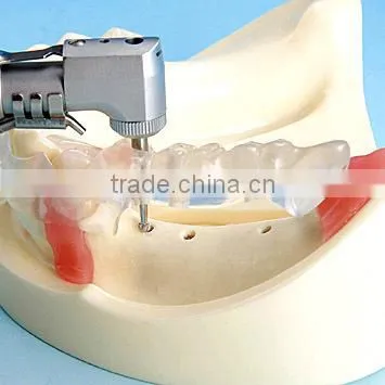 Typodont Orthodontic Model for Practicing Teeth Model Factory photo-4