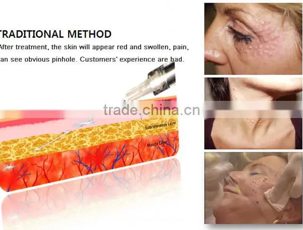 DQ-88 No Needle Mesotherapy|Mesotherapy Gun photo-3