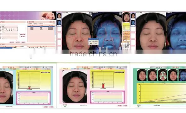 Sa100 Latest Excellent Magic Scoper Magic Mirror Skin Analysis photo-2