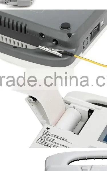 Beijing High Resolution Thermal Printing System 3.8 Inch LCD Three Channel Digital ECG Machine for Sale photo-6