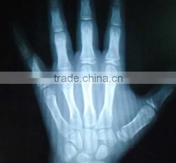 China KND-A/F CE Medical Dry Film Agfa Healthcare photo-4
