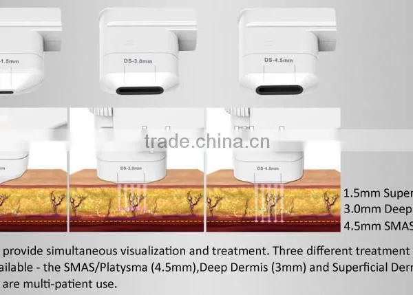 0.2-3.0J EVERSUN Hifu Laser Beauty Machine With 3 Transducer In 5.0-25mm Different Frequency HIFU Technology USA HIFU Korea HIFU Technology Anti-aging photo-3