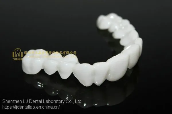 Dental PETG Clip on Veneers, Snap-on-veneers, Smile Veneers, Laboratoire Dentaire, Dentallabor, Laboratorio Dental, Dental Laboratory, Shenzhen LJ Dental Lab China
