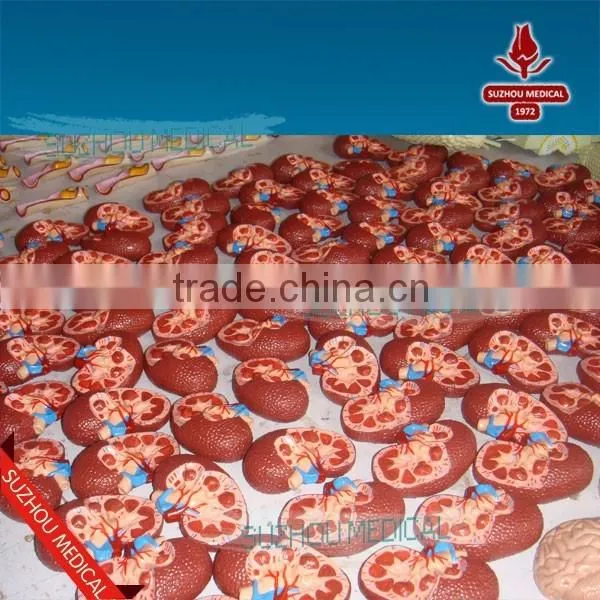 Effects of Hypertension, 5 Parts photo-5