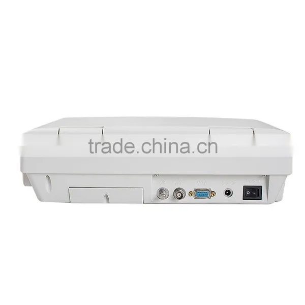 CE& FDA Approved Digital Portable Ultrasound Scanner Suitable for the Diagnosis of Abdomen, Cardiac, Gynecology, Obstetrics photo-3