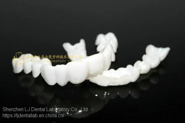 Dental PETG Clip on Veneers, Snap-on-veneers, Smile Veneers, Laboratoire Dentaire, Dentallabor, Laboratorio Dental, Dental Laboratory, Shenzhen LJ Dental Lab China photo-2