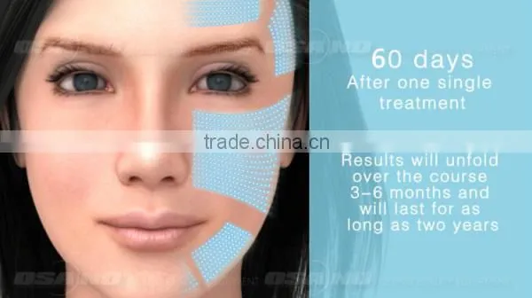 HIFU Wrinkle Removal Equipment / Hifu Face and Body photo-5