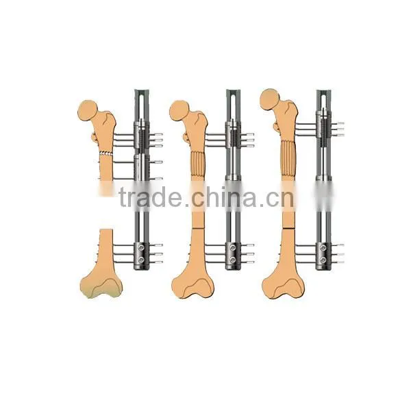 External Fixation Device photo-2